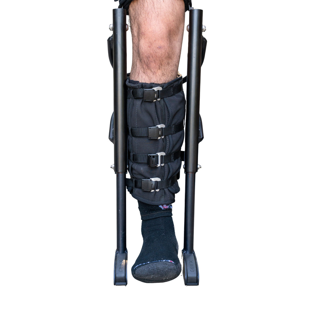 ORIF Surgery Recovery: Plates, Screws & Getting Back on Your Feet